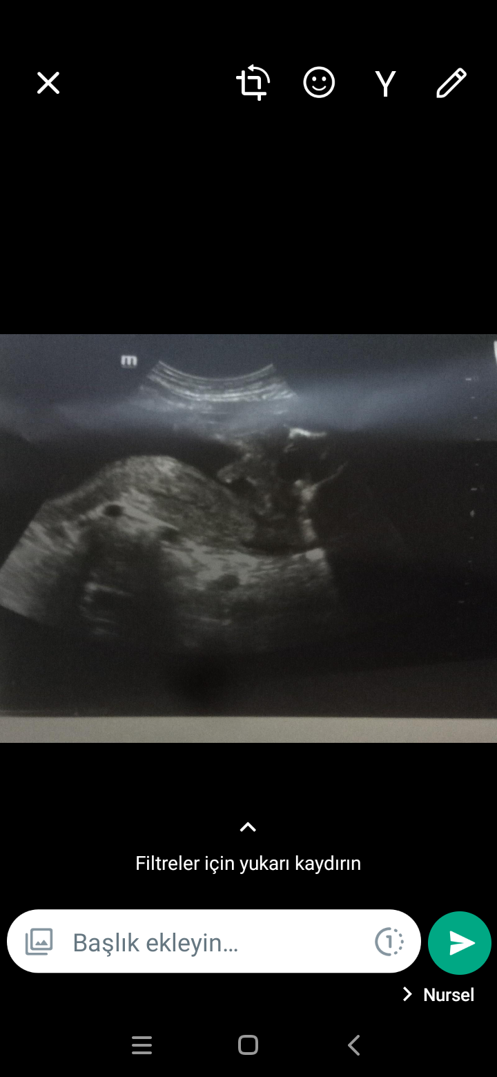 Screenshot_20220723-083150.png